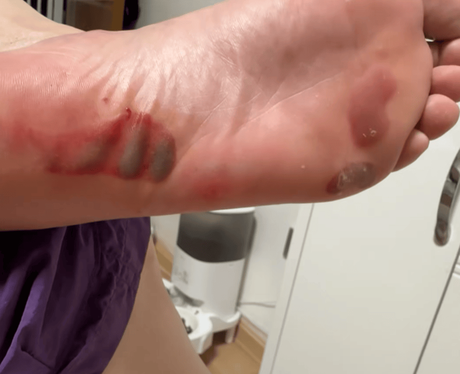 “月瘦20斤”“很多人都在用”<strong></p>
<p>宏鑫機(jī)械設(shè)備有限公司
</strong>！女子在家跟練突然腳底噴血……:宏鑫機(jī)械設(shè)備有限公司
