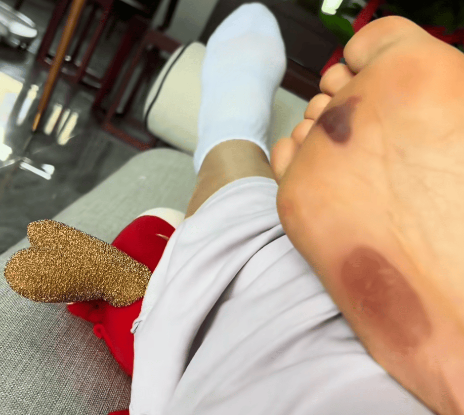 “月瘦20斤”“很多人都在用”<strong></p>
<p>宏鑫機(jī)械設(shè)備有限公司
</strong>！女子在家跟練突然腳底噴血……:宏鑫機(jī)械設(shè)備有限公司
