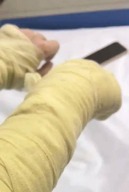 湖南一女主播被偽裝的包裹炸傷<strong></p>
<p>宏鑫機械設(shè)備有限公司
</strong>，永州公安：正在核實具體情況:宏鑫機械設(shè)備有限公司
