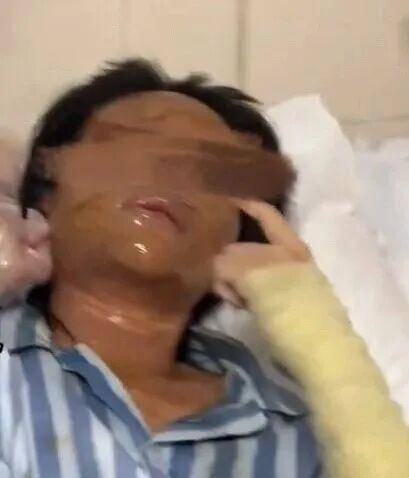 湖南一女主播被偽裝的包裹炸傷<strong></p>
<p>宏鑫機械設(shè)備有限公司
</strong>，永州公安：正在核實具體情況:宏鑫機械設(shè)備有限公司
