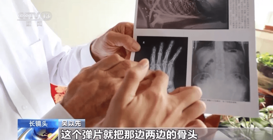 “老先生<strong></p>
<p>宏鑫機械設備有限公司
</strong>，您把項鏈取下來再做CT”:宏鑫機械設備有限公司
